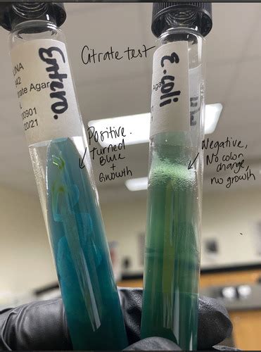 citrate utilization test quizlet.